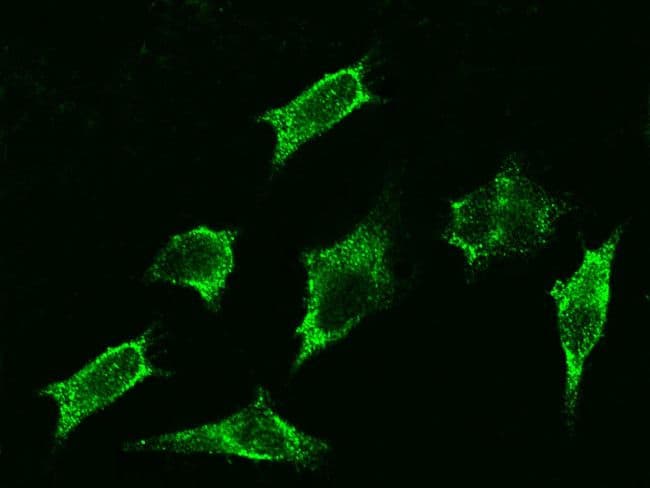 Beta 2 adrenergic receptor (B2AR) autoantibody